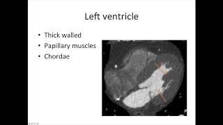 Cardiac anatomy for radiology  Part 1  cardiac chambers [upl. by Ahseikal]