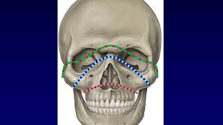 Facial Fractures 1 [upl. by Enelegna87]