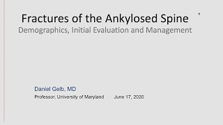 Fractures of the Ankylosed Spine [upl. by Rosemari]