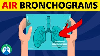 Flexible Bronchoscopy Introduction 8  Awake Intubation Part 1 [upl. by Yorker]