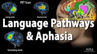 Language Pathways and Aphasia Animation [upl. by Beaufert]