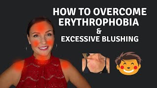 How To Cure Erythrophobia amp Excessive Blushing [upl. by Osrick]