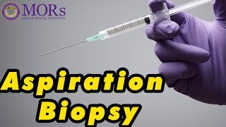 FINE NEEDLE ASPIRATION BIOPSY PROCEDURE [upl. by Birck]