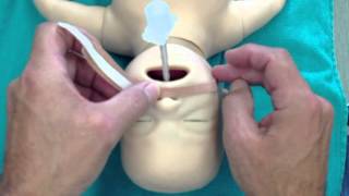 Taping a Neonatal ETT [upl. by Akinnej]