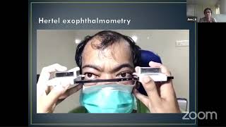 How to perform opthalmoscope exam [upl. by Nolyarb]