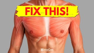 How to Fix Chest Muscle Tightness in 30 SECONDS [upl. by Atiniv]