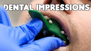 Dental Impressions amp Pouring Teeth Models [upl. by Turmel]