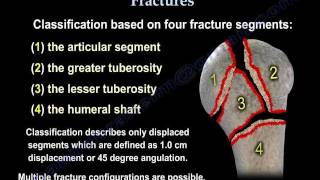 Proximal Humerus Fractures classification  Everything You Need To Know  Dr Nabil Ebraheim [upl. by Ahkihs526]