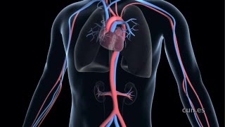 Transcatheter Aortic Valve Implantation TAVI [upl. by Erny]