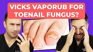 Ointment To CURE Toenail Fungus  Doctorly Investigates [upl. by Layton966]