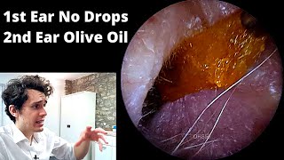 Ultra Sticky Ear Wax VS Olive Oil Treated Ear Wax [upl. by Gillett]