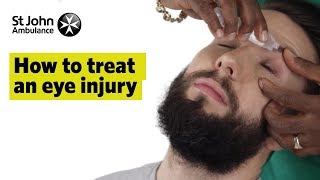 How to Treat An Eye Injury  First Aid Training  St John Ambulance [upl. by Annahsar299]