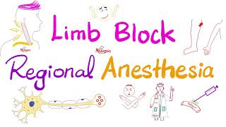 Limb Block  Peripheral Nerve Block  Regional anesthesia [upl. by Andrews]