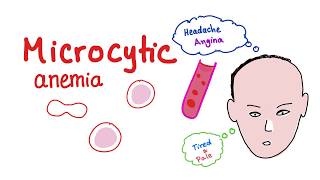 Microcytic Anemia introduction [upl. by Heurlin901]