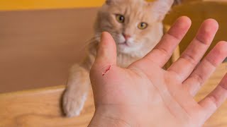 CAT SCRATCH DISEASE  BARTONELLA HENSELAE  Causes Symptoms Treatment Prevention Pathology [upl. by Greenfield]