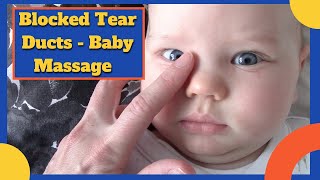 BABY BLOCKED TEAR DUCTS  Including massage video [upl. by Norrahc]