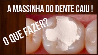 A quotMASSINHAquot  CURATIVO do dente caiu O QUE FAZER [upl. by Colpin]