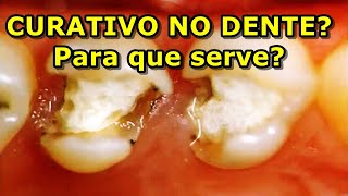 Curativo no dente  para que serve [upl. by Thurlow466]