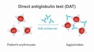 Recognizing the significance of poikilocytes [upl. by Sonnie]