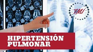 Hipertensión Pulmonar [upl. by Zaragoza471]