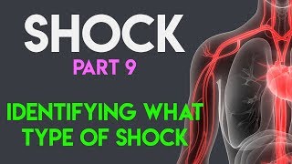 Identifying What Type Shock  Shock Part 9 [upl. by Edwyna935]