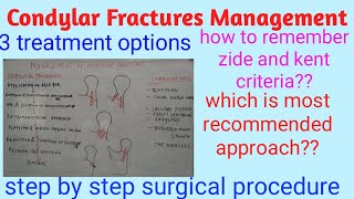 Condylar fractures management [upl. by Jo-Ann49]