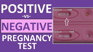 Pregnancy Test Positive vs Negative Results Time Lapse [upl. by Ggerg652]