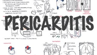 ECG Interpretation Practice  Pericarditis on EKG Explained [upl. by Clie]