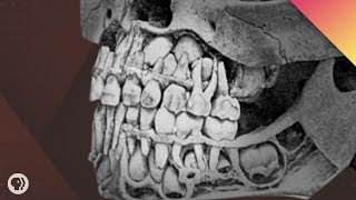 Where Do Teeth Come From [upl. by Oriaj]