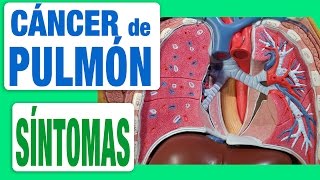 AUSCULTACIÓN PULMONAR ruidos normales y anormales [upl. by Nymzaj]