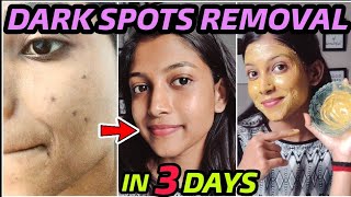 Remove DARK SPOTS NATURALLY in 3 Days 😍 Hyperpigmentation Acne Scars Brown Spots [upl. by Sasnak210]