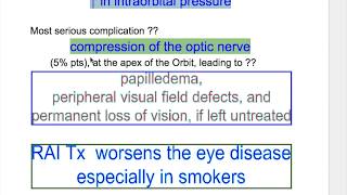 Exophthalmos Thyroid Ophthalmopathy [upl. by Friday930]