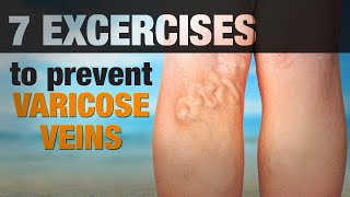 7 Exercises for Varicose Veins  Move with Cassy [upl. by Ottilie696]