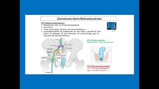 Zielvolumen bei der Bestrahlung vom Rektumkarzinom  Strahlentherapie Prof Hilke Vorwerk [upl. by Alesig290]