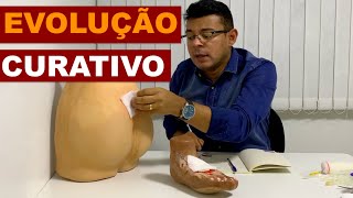 Evolução  Curativo [upl. by Adnwahsal]