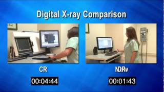 CR amp DR Comparison [upl. by Wagshul382]