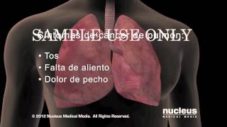 Ruidos Respiratorios Pulmonar  Auscultacion Pulmonar Semiologia [upl. by Jo Ann]