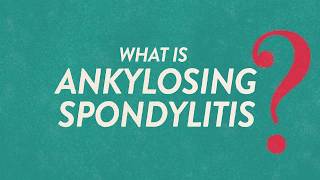 What Is Ankylosing Spondylitis Know the Symptoms  Backsplaining [upl. by Klara]